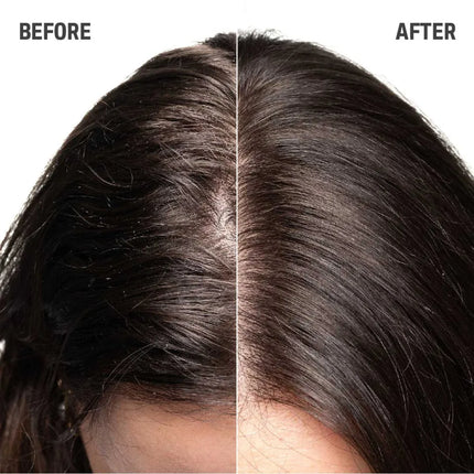 Goldwell Goldwell Scalp Specialist Sensitive Foam Shampoo