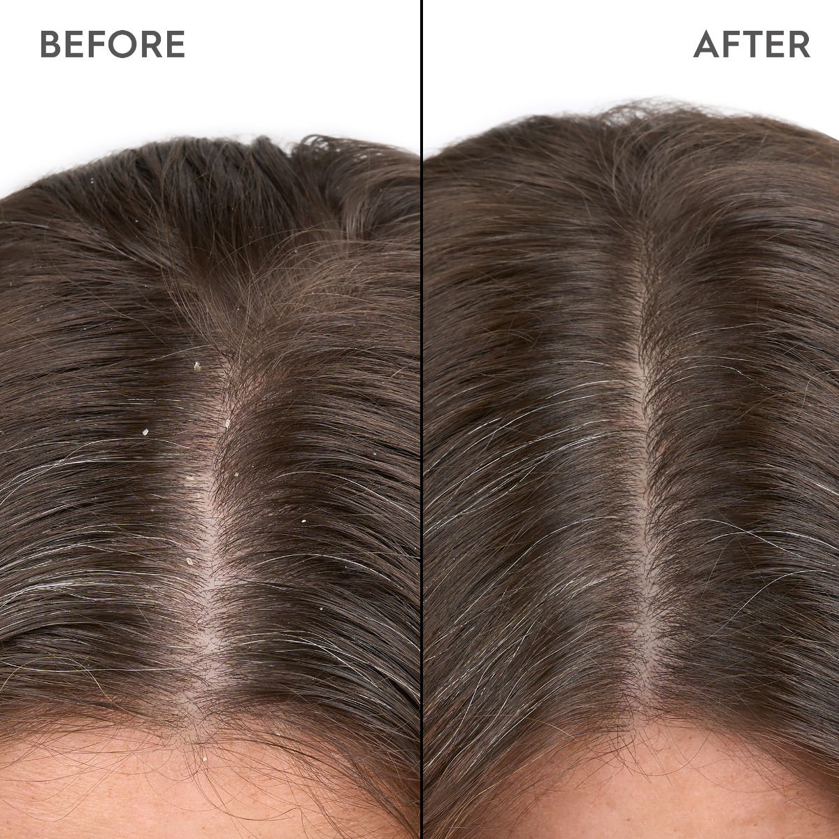 Kerasilk Anti-Dandruff Scalp Serum 100ml kopen bij Hairwebshop