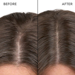 Kerasilk Anti-Dandruff Scalp Serum 100ml kopen bij Hairwebshop