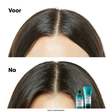 L'Oreal Professionnel L'Oreal Scalp Advanced Anti-Discomfort Shampoo Refill